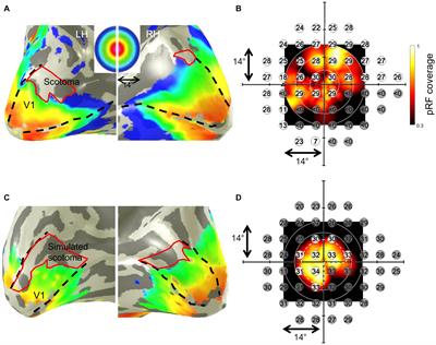 Mapping Visual Field Defects With fMRI – Impact of Approach and Experimental Conditions